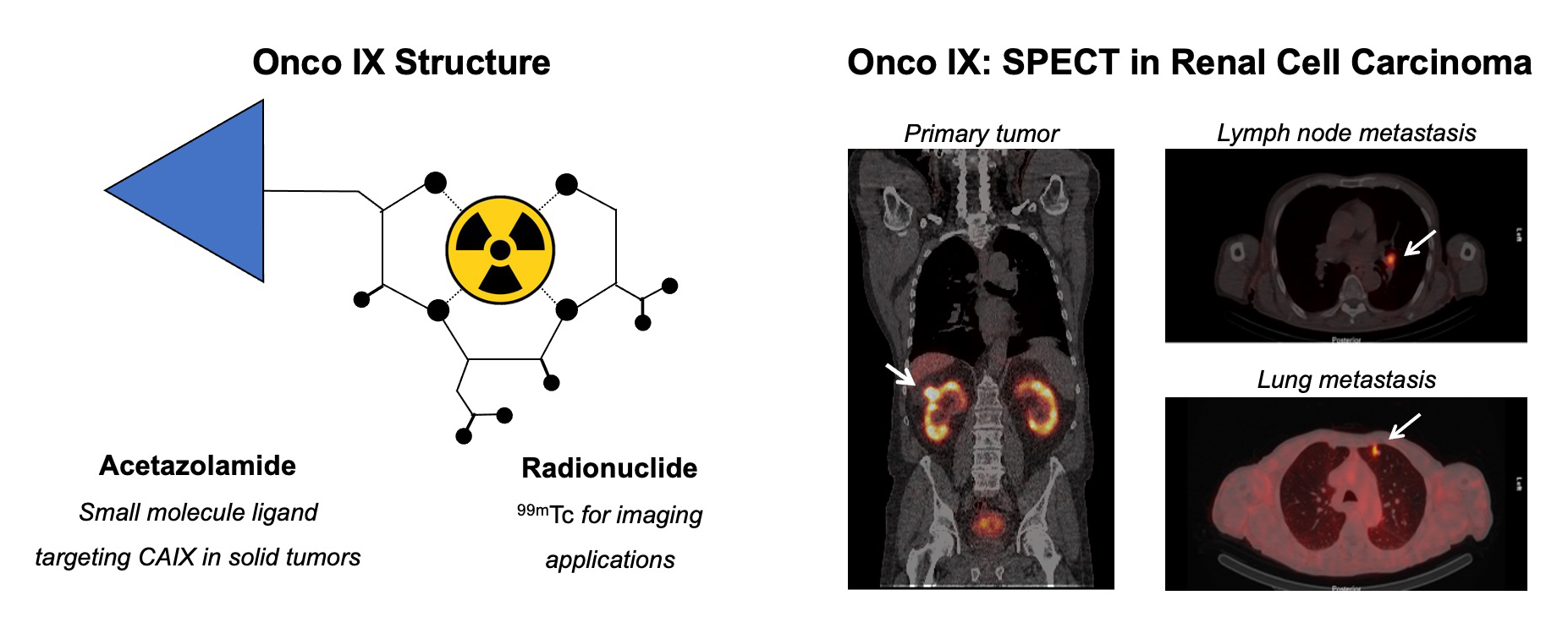 onco-ix-phc-102-imaging